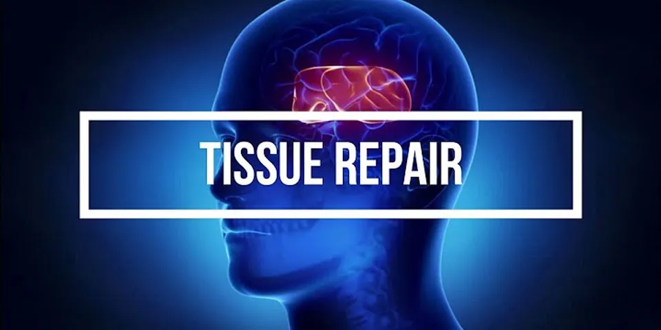 List and describe the 3 main steps of how tissue is repaired